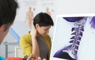 Treatment of cervical osteochondrosis